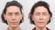 Slider image (6) AB Plastic Surgery
